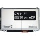 Kijelző a Toshiba Satellite CL15T SERIES 11,6" HD LED Slim 30 pin eDP laptop részére - Fényes